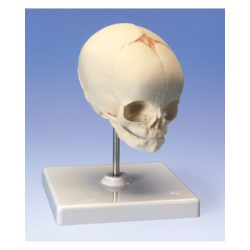 Cranio di feto, su cavalletto