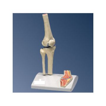 Mini articolazione del ginocchio con sezione trasversale, su base