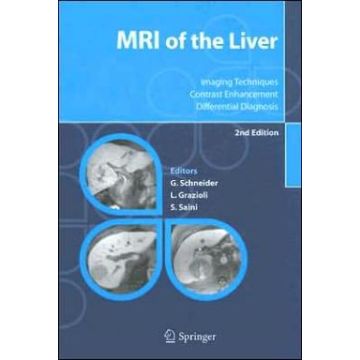 Mri Of The Liver. Imaging Techniques, Contrast Enhancement, Differential  Diagnosis - Schneider Guenther; Grazioli Luigi; Saini Sanjay - Springer Verlag Italia - 9788847002098