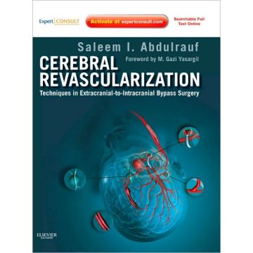 Cerebral Revascularization - Techniques in Extracranial-to-Intracranial Bypass Surgery: Expert Consult - Online and Print