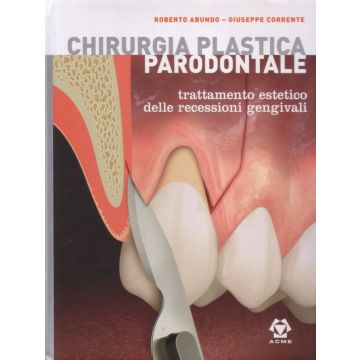 Chirurgia Plastica Parodontale. Trattamento Estetico delle recessioni gengivali + Appendici e cofanetto