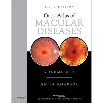 Gass' Atlas of Macular Diseases, 5th Edition - 2-VOLUME SET - EXPERT CONSULT: ONLINE AND PRINT   [Agarwal  - ELSEVIER SCIENCE]