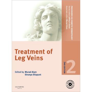 Procedures in Cosmetic Dermatology Series: Treatment of Leg Veins, 2nd Edition - TEXT WITH DVD
