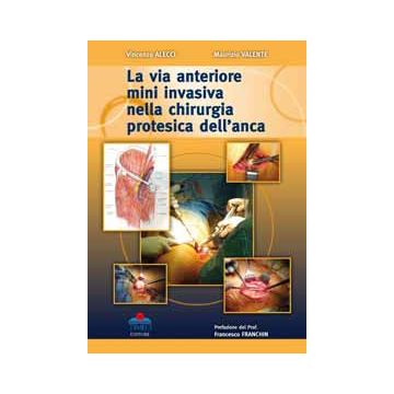 La via anteriore mini invasiva nella chirurgia protesica dell'anca [Alecci - Timeo Editore]