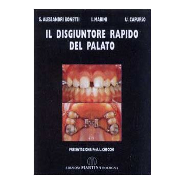 Il disgiuntore rapido del palato
