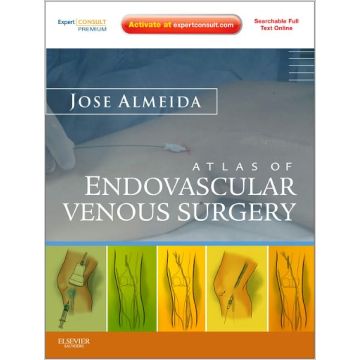 Atlas of Endovascular Venous Surgery - Expert Consult - Online and Print