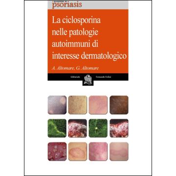 La Ciclosporina nelle patologie autoimmuni di interesse dermatologico