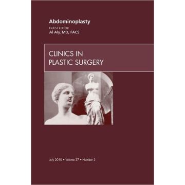 Abdominoplasty, An Issue of Clinics in Plastic Surgery 