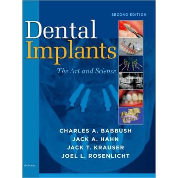 Dental Implants, 2nd Edition The Art and Science
