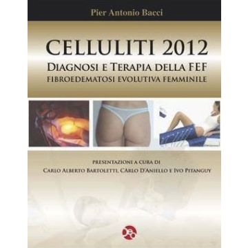 CELLULITI 2012 - Diagnosi e terapia della FEF (Fibroedematosi Evolutiva Femminile) [Bacci Pier Antonio - Officina Editoriale]