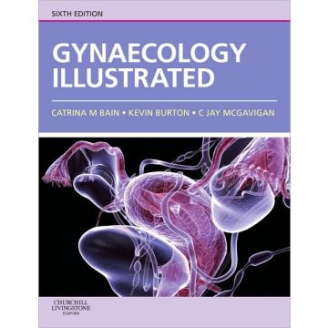 Gynaecology Illustrated, 6th Edition 