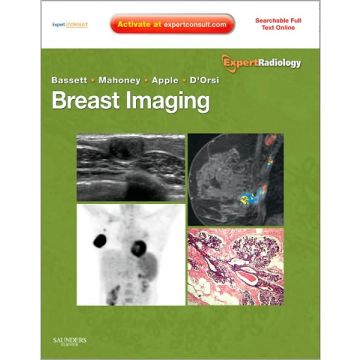 Breast Imaging - EXPERT RADIOLOGY SERIES EXPERT CONSULT- ONLINE AND PRINT