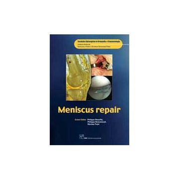 Meniscus Repair
