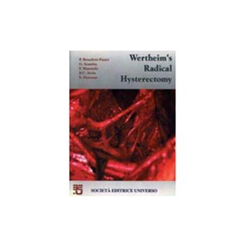 WERTHEIM' S RADICAL HYSTERECTOMY