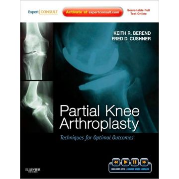 Partial Knee Arthroplasty - Techniques for Optimal Outcomes with DVD; Expert Consult - Online & Print 