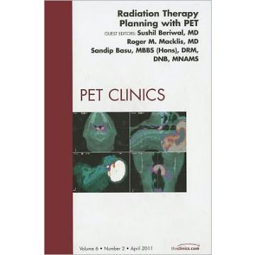 Radiation Therapy Planning with PET, An Issue of PET Clinics