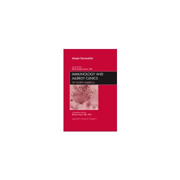Atopic Dermatitis, An Issue of Immunology and Allergy Clinics