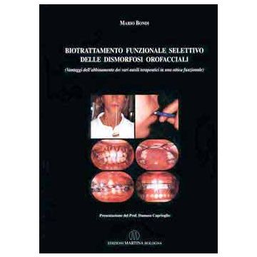Biotrattamento funzionale selettivo delle dismorfosi orofacciali