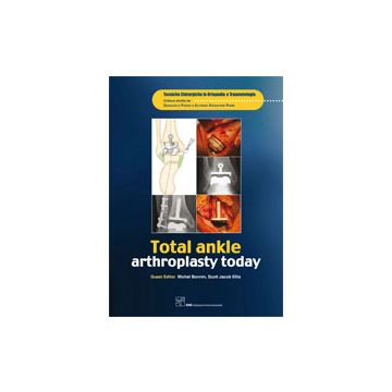 Total ankle arthroplasty today  [Bonnin  - CIC EDIZIONI INTERNAZIONALI]