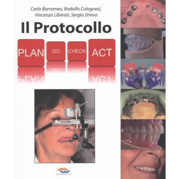 Il Protocollo - PLAN DO CHECK ACT