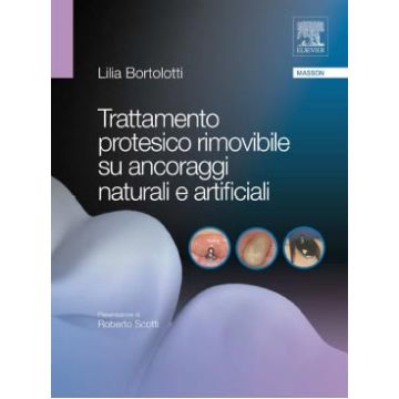 Trattamento protesico rimovibile su ancoraggi naturali e artificiali  [Bortolotti - Elsevier Masson]