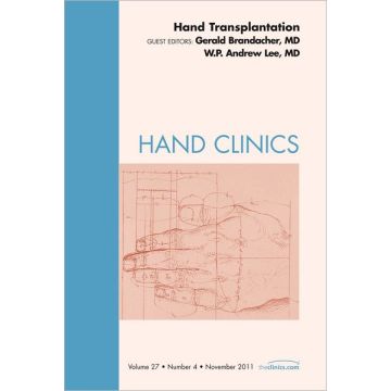 Hand Transplantation, An Issue of Hand Clinics  [Brandacher  - ELSEVIER SCIENCE]