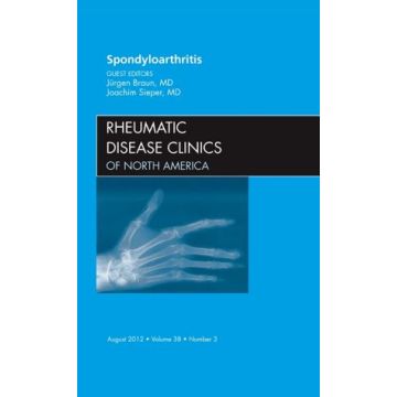 Spondyloarthropathies, An Issue of Rheumatic Disease Clinics  [Braun  - Elsevier Science]