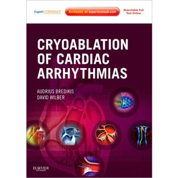 Cryoablation of Cardiac Arrhythmias - Expert Consult - Online and Print