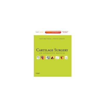 Cartilage Surgery An Operative Manual, Expert Consult: Online and Print