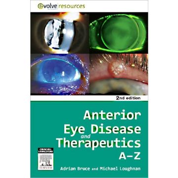 Anterior Eye Disease and Therapeutics A-Z, 2nd Edition