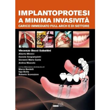 Implantoprotesi a minima invasività. Carico immediato Full Arch e di settore  [Bucci Sabattini - Griffin Editore]
