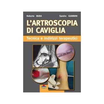 L'artroscopia Di Caviglia, Tecnica e Indirizzi Terapeutici [Buda; Giannini - Timeo Editore]