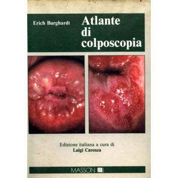 Atlante di colposcopia. (a cura di Carenza Luigi)