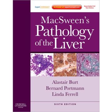 MacSween's Pathology of the Liver, 6th Edition - Expert Consult: Online and Print