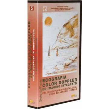 Ecografia color Doppler ed imaging integrato: Ecografia color Doppler in ginecologia