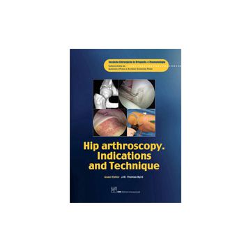 Hip Arthroscopy - Indications and Technique