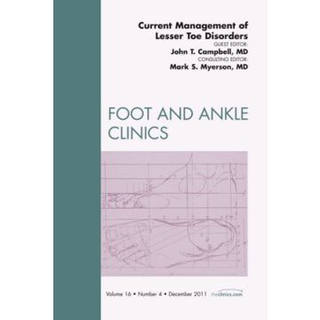 Current Management of Lesser Toe Disorders, An Issue of Foot and Ankle Clinics   [Campbell  - ELSEVIER SCIENCE]