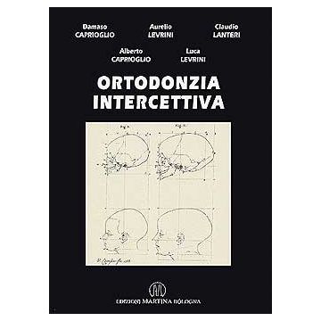 Ortodonzia intercettiva