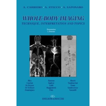 Whole-Body Imaging. Technique, interpretation and topics