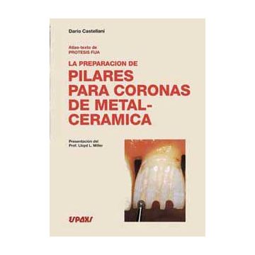 Atlas-texto de Protesis Fija - La preparacion de Pilares para coronas de metal-ceramica