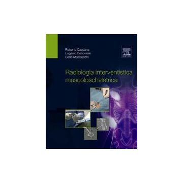 Radiologia Interventistica Muscoloscheletrica  [Caudana Genovese Masciocchi - Edra Elsevier Masson]