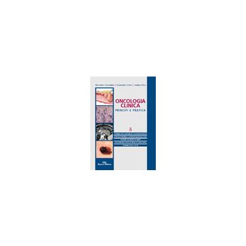 Oncologia clinica. Principi e pratica vol. 5    [Cellerino - Selecta Medica]