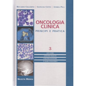 Oncologia clinica. Principi e pratica vol. 3 - Leucemie, Linfomi maligni, Paraproteinemie, Tumori pediatrici [Cellerino - Selecta Medica]