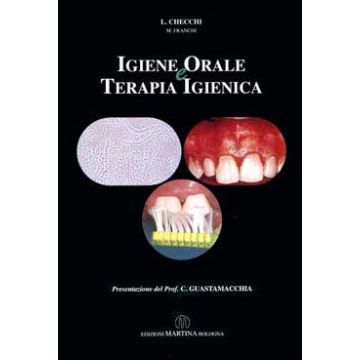 Igiene orale e terapia igienica