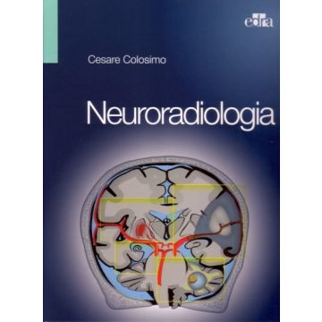 COLOSIMO NEURORADIOLOGIA EDRA
