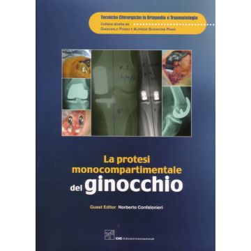 La Protesi monocompartimentale del Ginocchio
