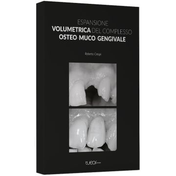 Espansione volumetrica del complesso osteo muco gengivale roberto crespi tueor