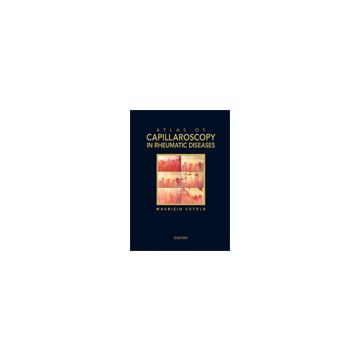 Atlas of capillaroscopy in rheumatic diseases        [Cutolo  - Elsevier Masson]
