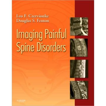 Imaging Painful Spine Disorders - Expert Consult