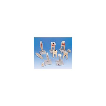Serie di denti, 5 modelli